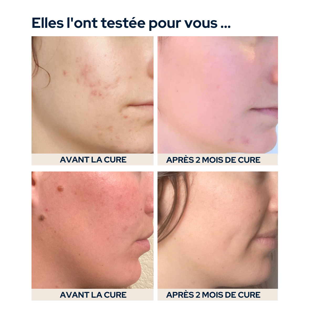 Cure Hydratation & peau nette