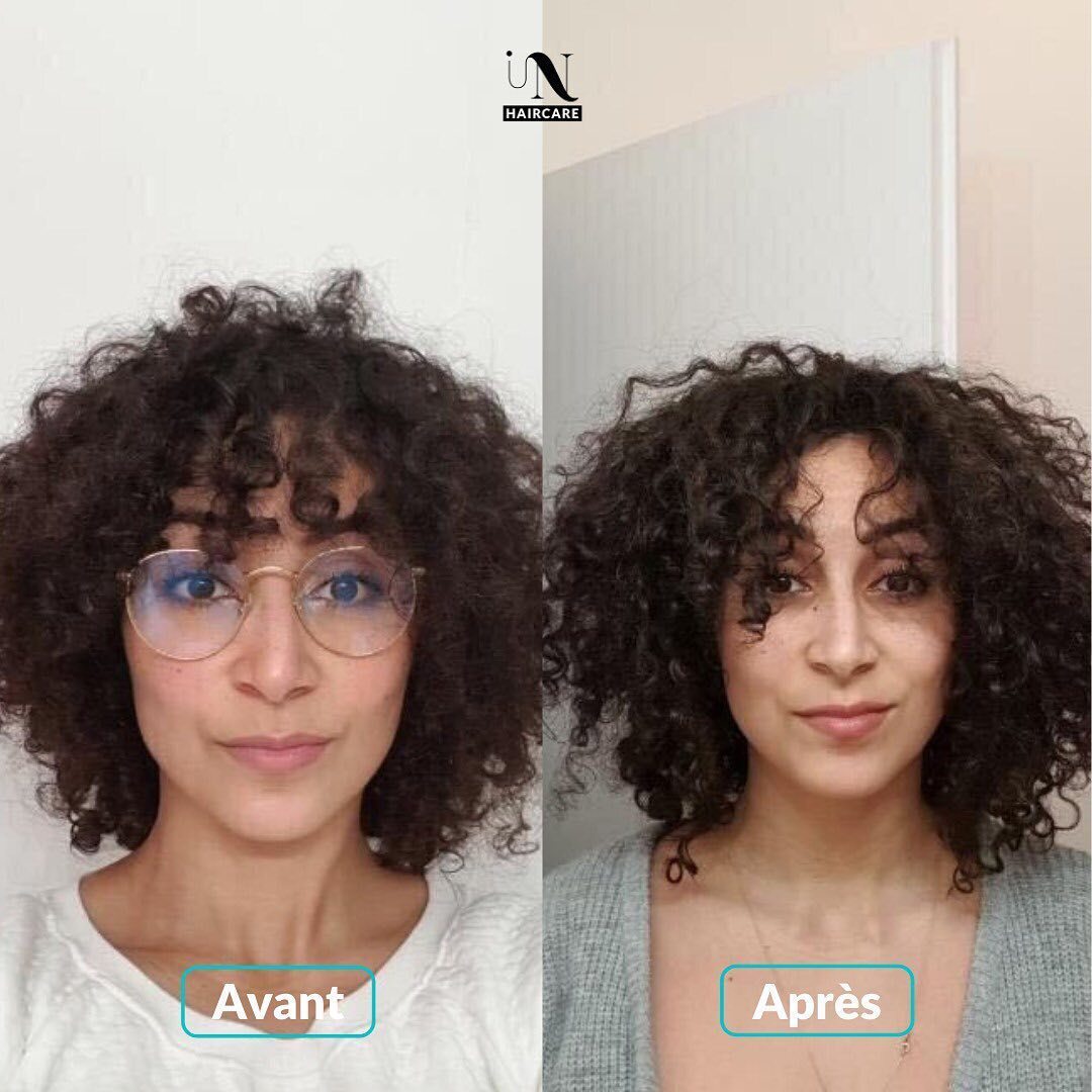 Avant après Cure pousse de cheveux 1 mois 